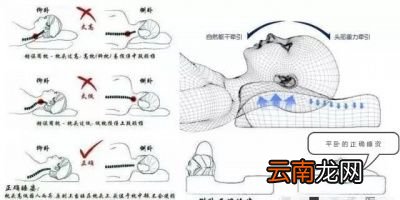 患有颈椎病的人在生活中要注意些什么