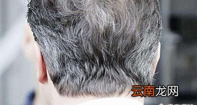 人体已经变白的头发能重新变黑吗