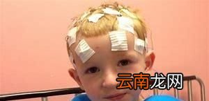 注意事项患有高血压的人不宜吃味精