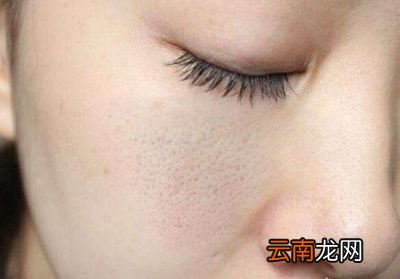 怎么能让毛孔变小可以这样做