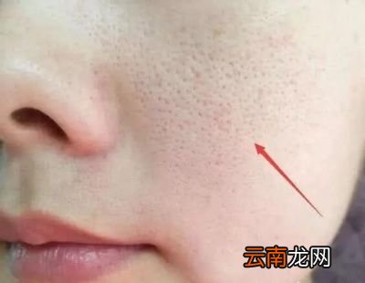 怎么能让毛孔变小可以这样做