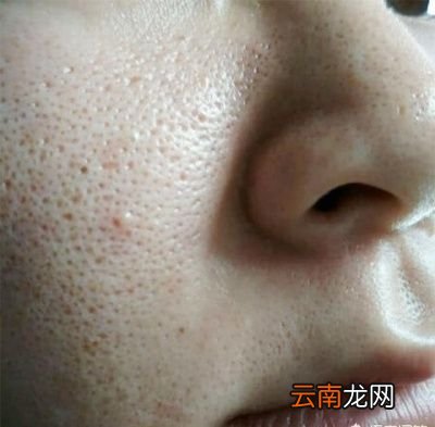 怎么能让毛孔变小可以这样做