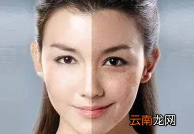 为什么孕妇皮肤会变黑呢