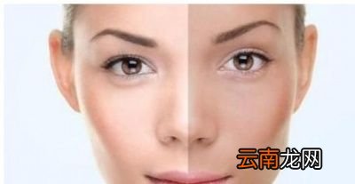 为什么怀孕后孕妇皮肤会变黑呢