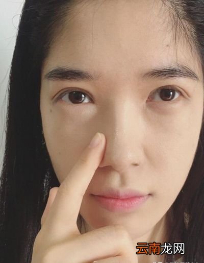 黑头是怎么形成的用3招消除20年黑头