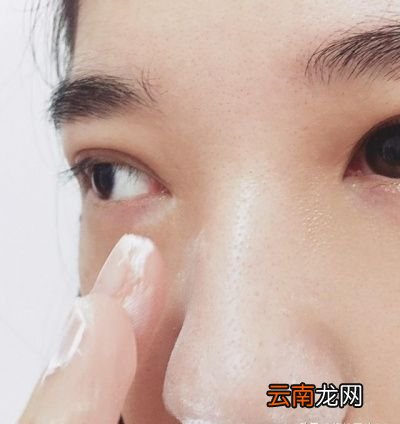 黑头是怎么形成的用3招消除20年黑头