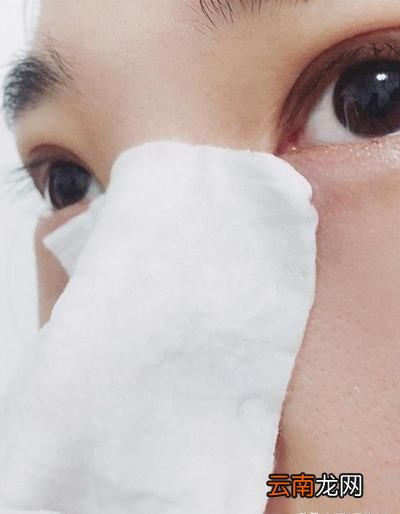 黑头是怎么形成的用3招消除20年黑头