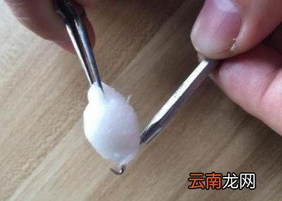 黑头是怎么形成的为什么总是挤了又长