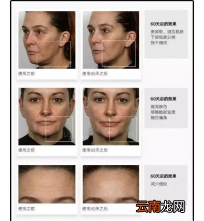 但它瘦脸效果怎么样呢