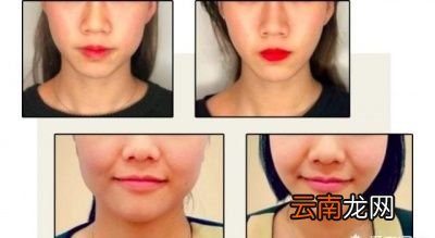 但它瘦脸效果怎么样呢