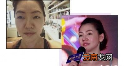 但它瘦脸效果怎么样呢