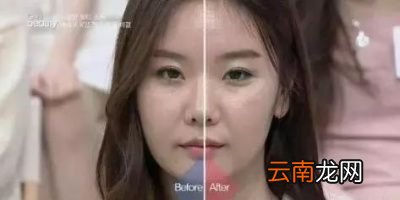 怎么瘦脸我们先来看胖脸的因素