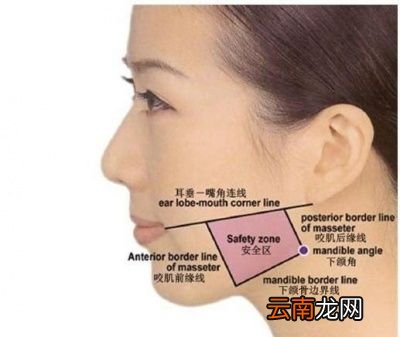如何选择瘦脸针和你适不适合打瘦脸针