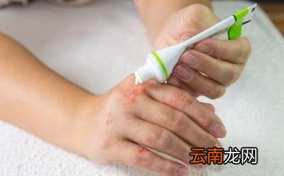 指甲上出现凹横杠是什么病