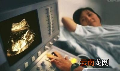 怀孕次做B超主要查什么