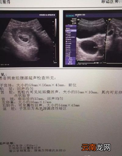 如何选择阴试彩超或者腹式彩超
