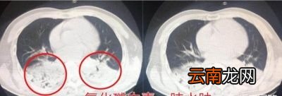 如何预防一氧化碳中毒
