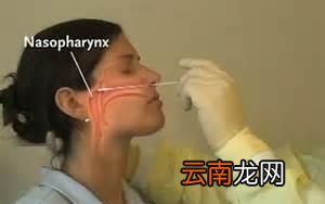什么是新冠病毒的核酸检测