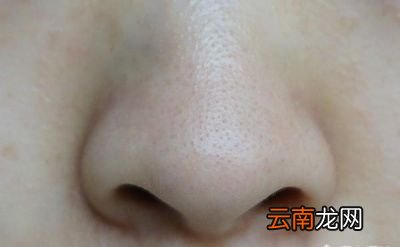 如何祛除脸上的螨虫