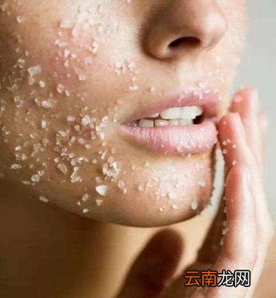 脸上有螨虫应该怎么除螨呢