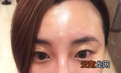 如何自测脸上螨虫多不多可以从这5方面观察
