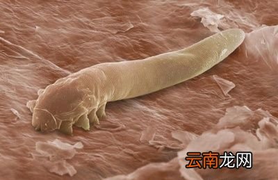 什么时候螨虫会变的有害呢