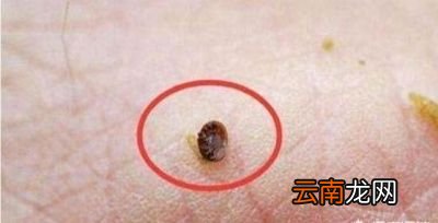 一招判断出脸上是否有螨虫