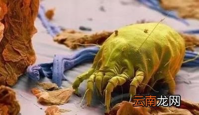 脸上大颗红肿的痘痘是螨虫痘吗