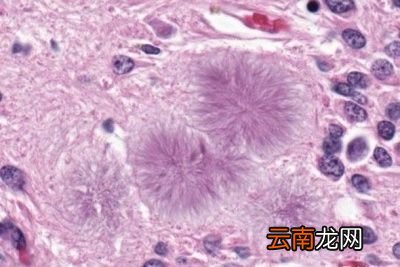 像新冠这样的病毒在冷鲜肉产品中能存活多久