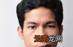 面瘫有哪些症状