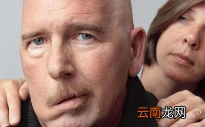 面瘫有哪些症状