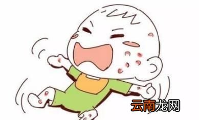 婴儿湿疹严重有必要把母乳停掉换水解奶粉吗