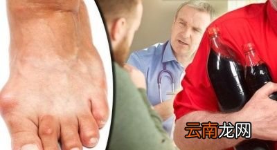 为什么尿酸会升高呢