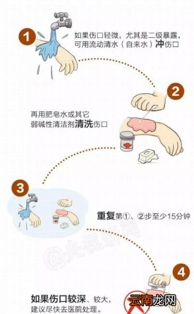 被打过疫苗的狗咬伤后是否需要接种疫苗