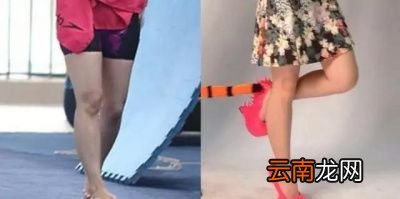解决方法瘦腿针瘦小腿肚子+拉伸运动