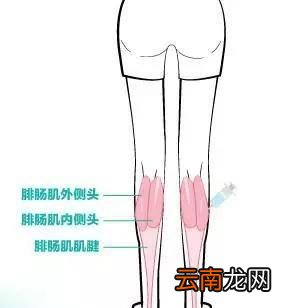 解决方法瘦腿针瘦小腿肚子+拉伸运动