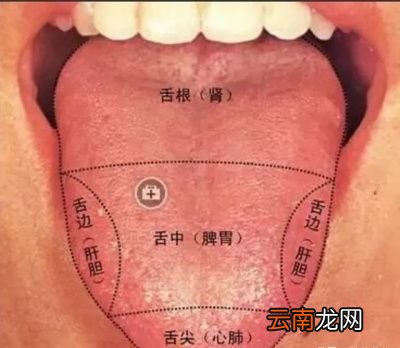 阴虚火旺的症状有哪些应该注意什么