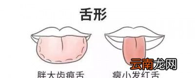 阴虚火旺的症状有哪些应该注意什么