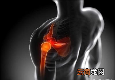 肩部疼痛和肩部活动度降低的常见原因