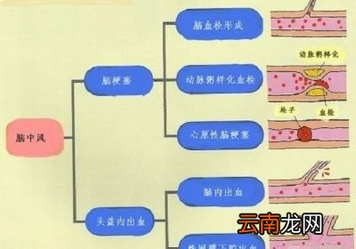 六要吃叶酸片补充叶酸吗