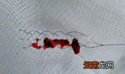 六要吃叶酸片补充叶酸吗