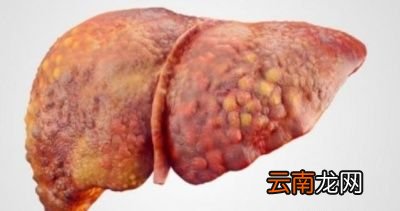 最伤肝的食物是什么呢