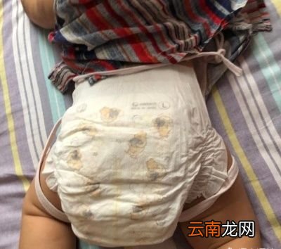 京妈建议怎么做可以预防宝宝出现红屁屁