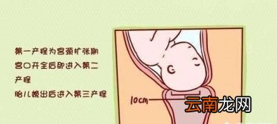 如何加快宫口开指速度
