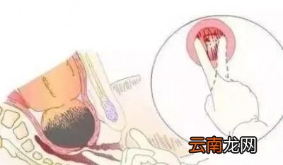 “开几指”到底怎么度量