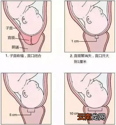 “开几指”到底怎么度量