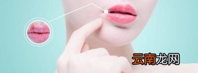 嘴唇总是起皮是怎么回事原因有3点