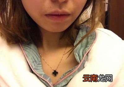 干裂嘴唇如何护理