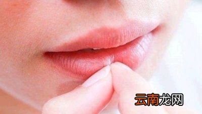 干裂嘴唇如何护理