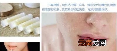 嘴唇经常性干裂和起皮这是什么原因